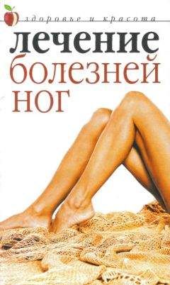 Савельева Юлия - Лечение болезней ног